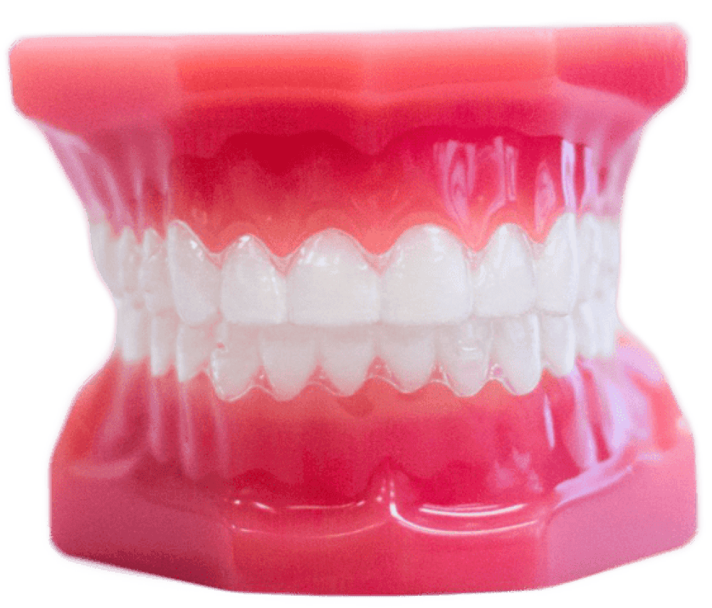 invisalign aligners on plastic model